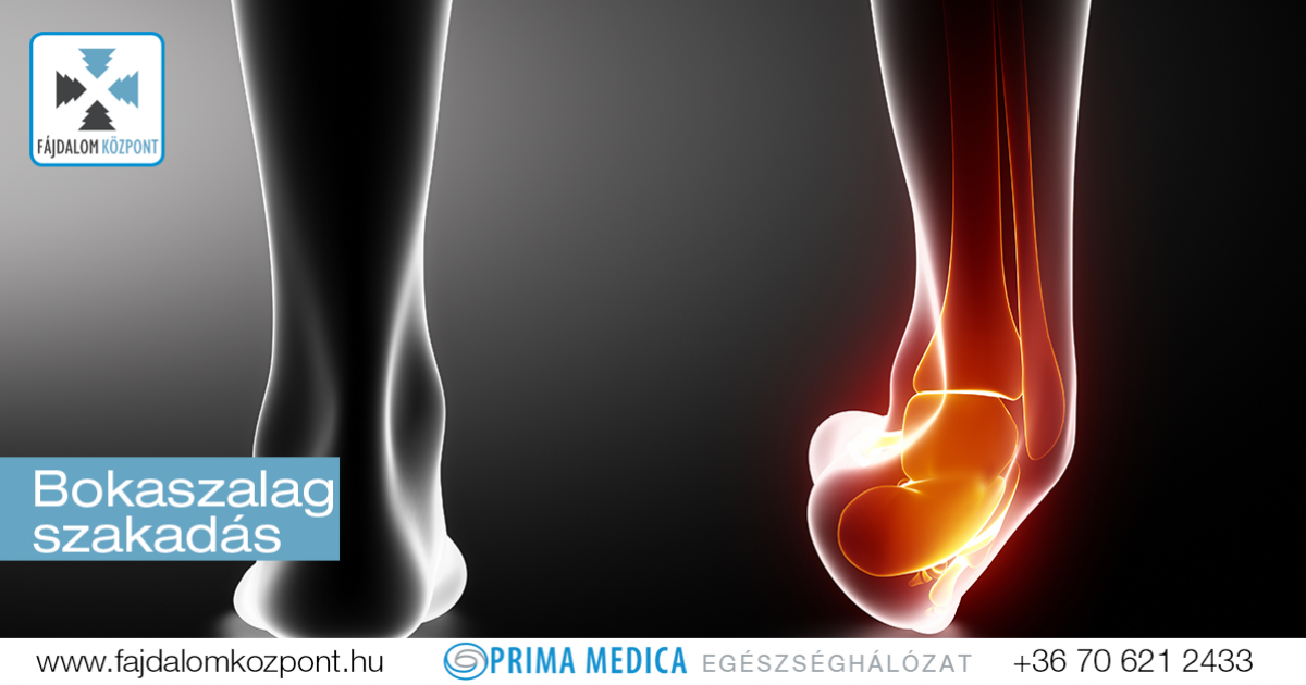 lábfej inszalag húzódás antibiotikumok ízületi és izomfájdalmak kezelésére