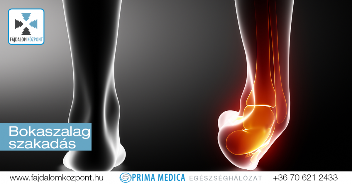 oldalsó ligamentum sérülés térdkezelés)