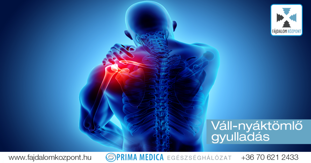 hogyan kell kezelni a vállízületi gyulladást