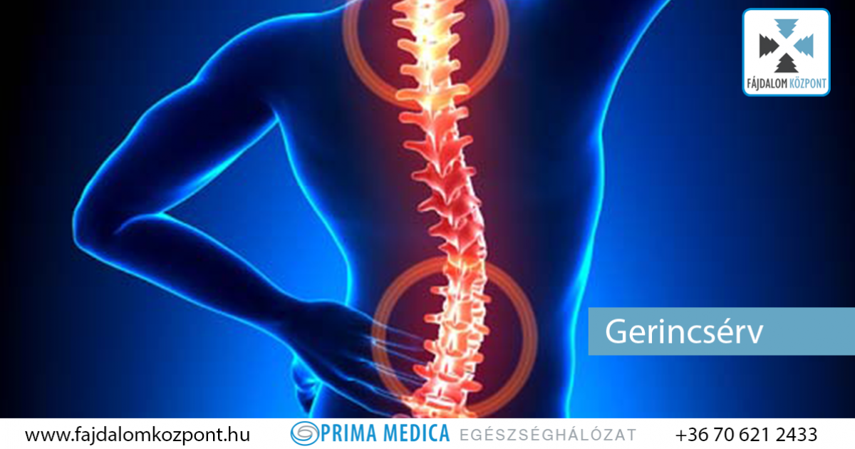 fájdalom a gerinc mindkét oldalán rheumatoid arthritis 1. szakasz