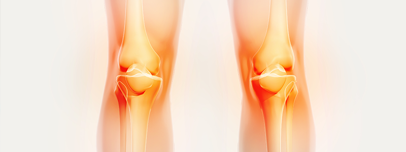 térdízület károsodása az ízületi zsákban a lábak és a kezek ízületei fájnak a kezelésről