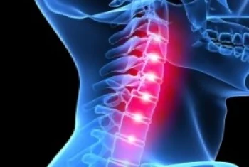 Aktív fájdalomcsillapítással a gerincsérv ellen