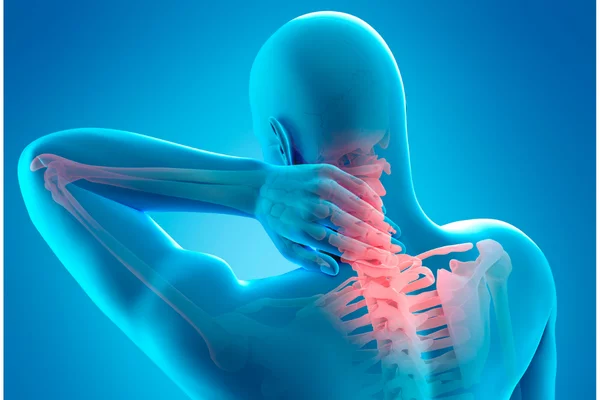 Nyaki gerinc fájdalom és csillapítása -Fájdalomközpont