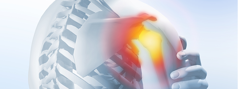 cervical osteoarthritis medscape ahol az artrózist és az asztrahánt kezelni lehet