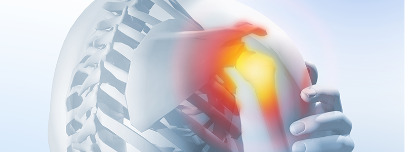 Rotátorköpeny-szakadás - okai, tünetek, kezelése