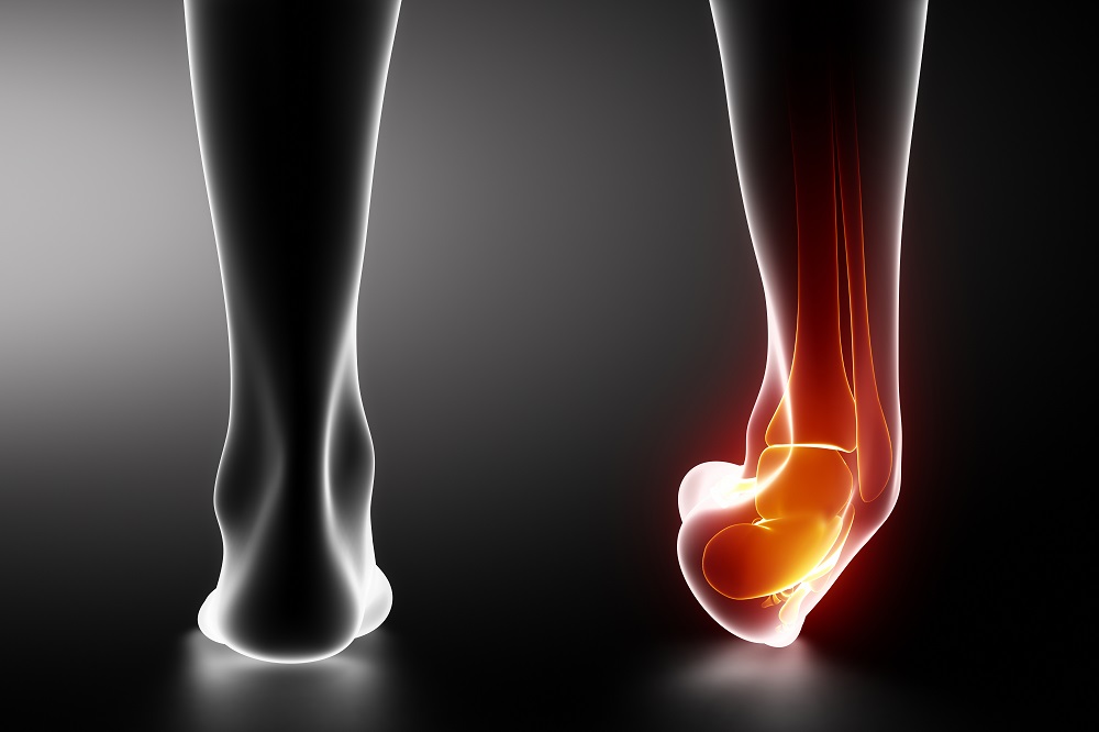 A külső bokaízület fáj - A duzzadt láb “egyszerűbb” okai
