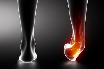 Rheumatoid arthritis működése a lábakban