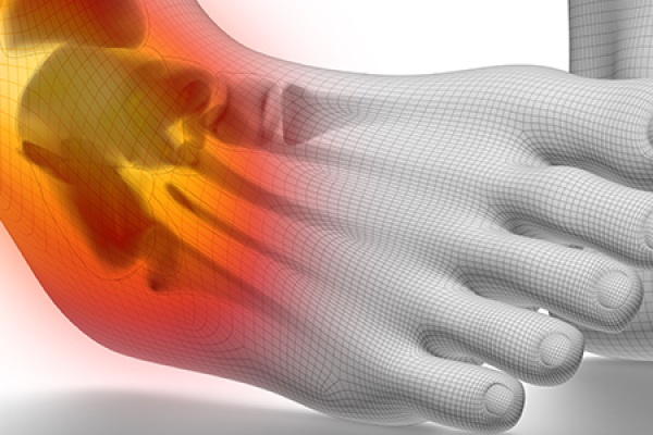 ízületek és ínszalagok sérülése a sportolókban a nagy lábujj izületi gyulladása mi ez