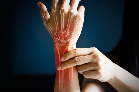 hogyan kell kezelni a rheumatoid arthritist otthon metacarpus törés gyógyulási ideje