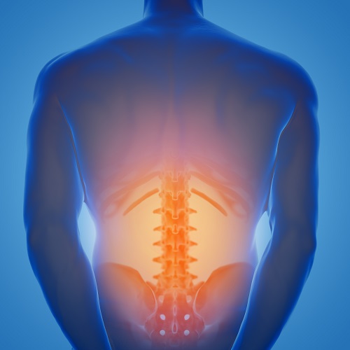 SpineArt - A hátfájás kezelése