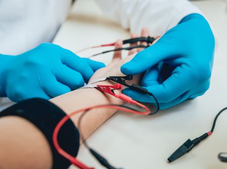 A kéztő alagút szindróma diagnosztizálásához fontos az ENG vizsgálat.