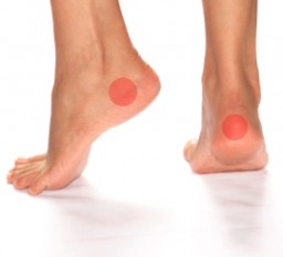 a jobb láb tarsusának ízületei artrózisa
