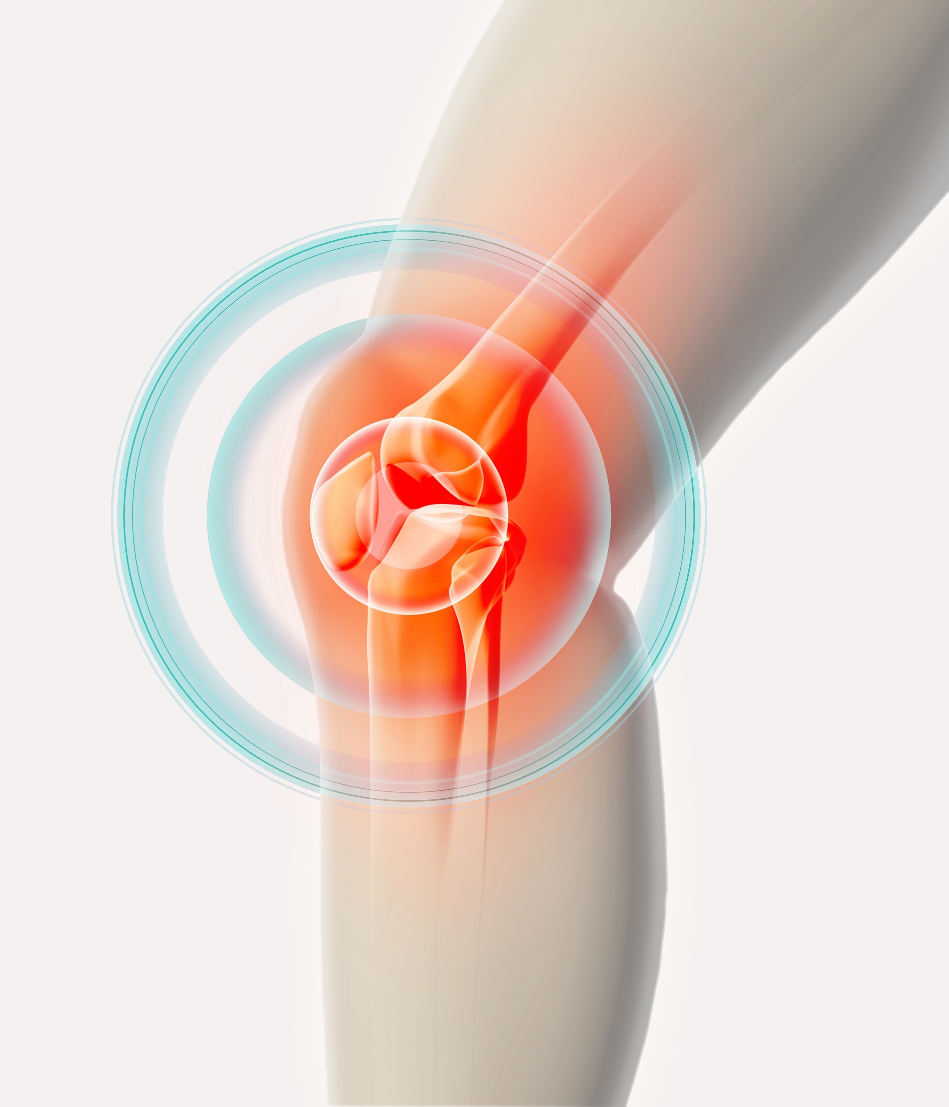 fájdalom a csípőízület izmain járás közben serdülőkorban a lábak ízületeinek fájdalma